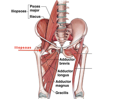 This condition may occur as a result of overuse associated with repeated hip flexion and rotation of the femur e.g. in professional dancing, gymnastics and playing football